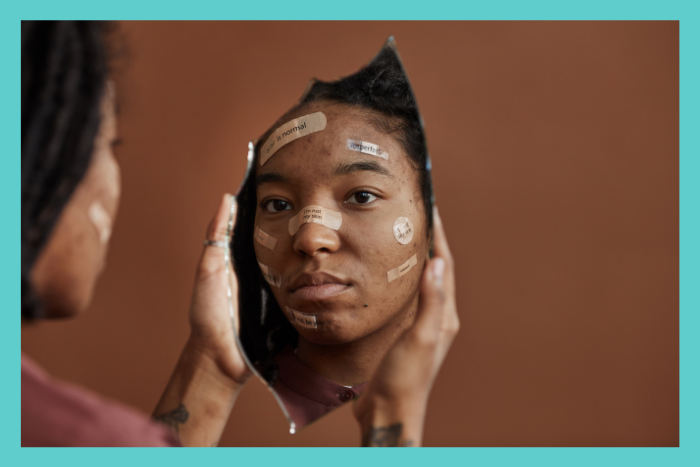 Person with facial bandages looks at their reflection in a broken mirror, conveying self-esteem and body-image challenges.